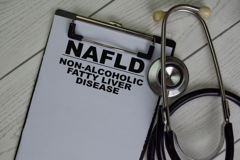 NAFLD