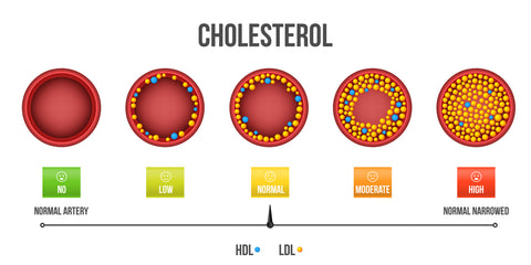 cholesterol levels compared in blood vessel