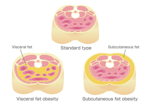different types of fat deposition on the body