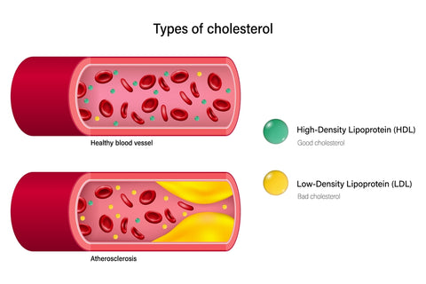 ldl and hdl cholesterol