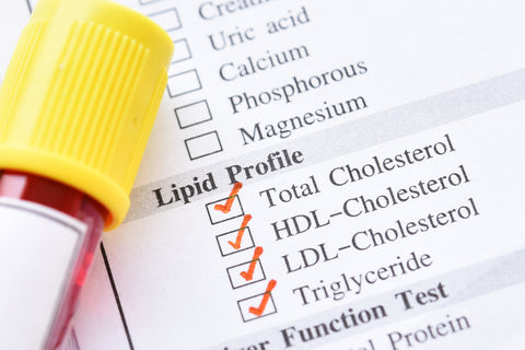 lipid profile