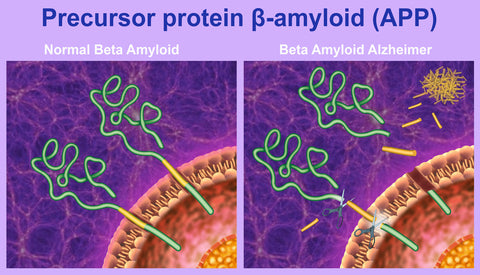 normal and abnormal beta amyloid protein in the brain