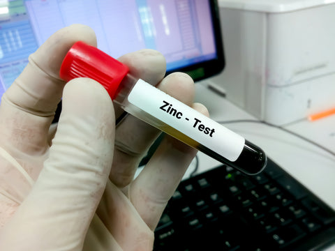 zinc serum test