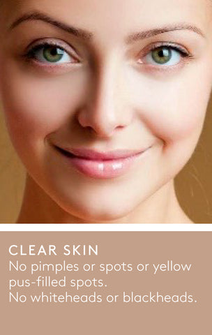 An example of clear skin showing a woman's face with no visible pimples, spots or other blemishes.