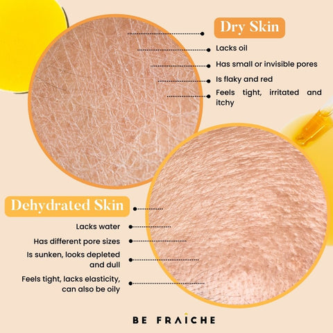 Dry vs Dehydrated Skin infographic by Be Fraiche
