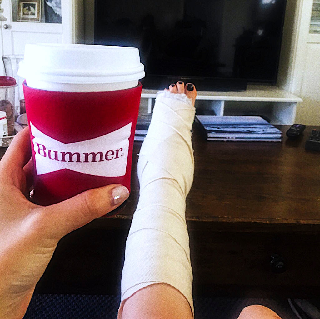 Propped up bandaged leg, holding a cup with a coozy that says Bummer