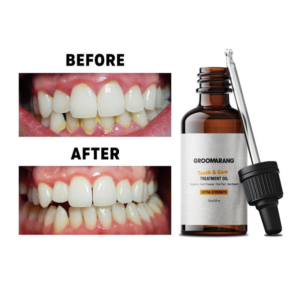 Groomarang Tooth & Gum Treatment Oil 30ml - Extra Fresh and Extra Strength 6