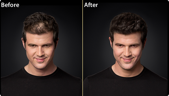 Toppik Men Before and After Preview