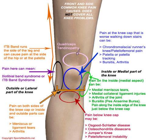Read Me If You Have Knee Pain!
