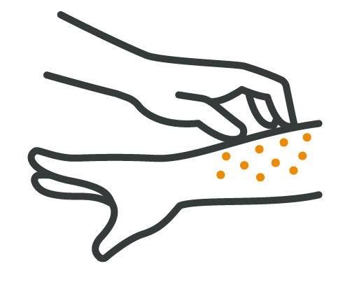 line art icon of a hand scratching an arm with spots
