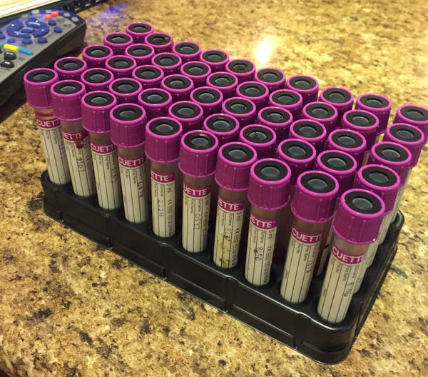 DNA samples for the American Angus Association