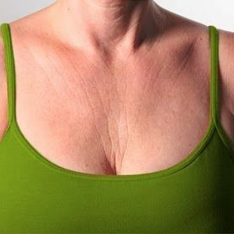 Neglecting Your Décolletage Causes Premature Aging of the Skin