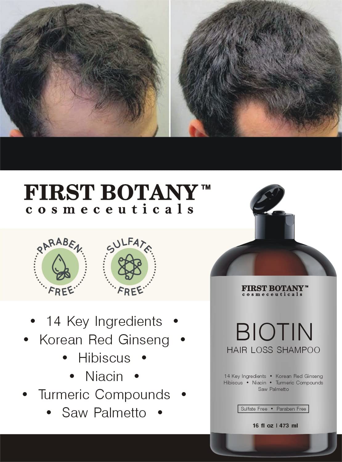 Hair Regrowth and Anti Hair Loss Shampoo 16 fl oz, with DHT blockers- –  First Botany