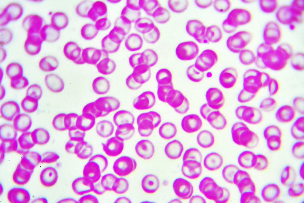 Red blood cell anemia
