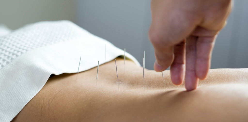 Acupuncture and the American Lifestyle