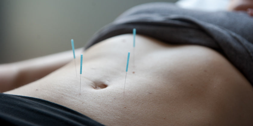 acupuncture athletic recovery