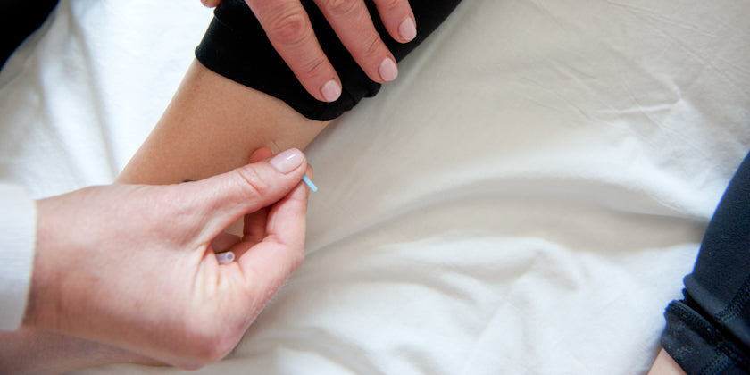 acupuncture athletic recovery