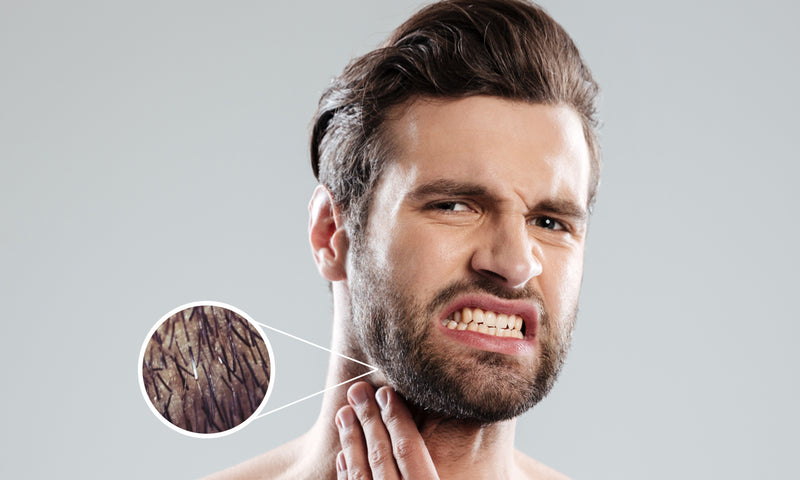 how-to-avoid-pesky-ingrown-beard-hairs-the-rugged-bros