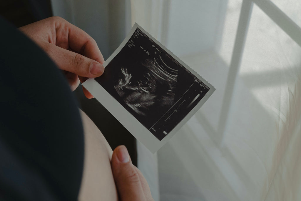 Pregnant woman holding an ultrasound picture.