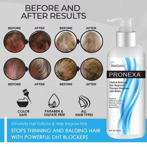 Hairgenics Pronexa Clinical Strength Hair Growth & Regrowth Therapy Hair Loss Shampoo With Biotin, Collagen, and DHT Blockers for Thinning Hair