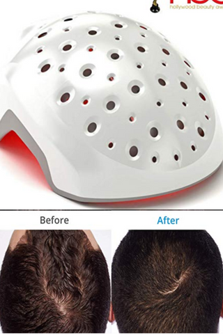 heradome EVO LH40 - Medical Grade Laser Hair Growth Helmet - FDA Cleared for Men & Women. Promotes Hair Regrowth and Prevents Further Hair Loss with Premium Red Light Lasers