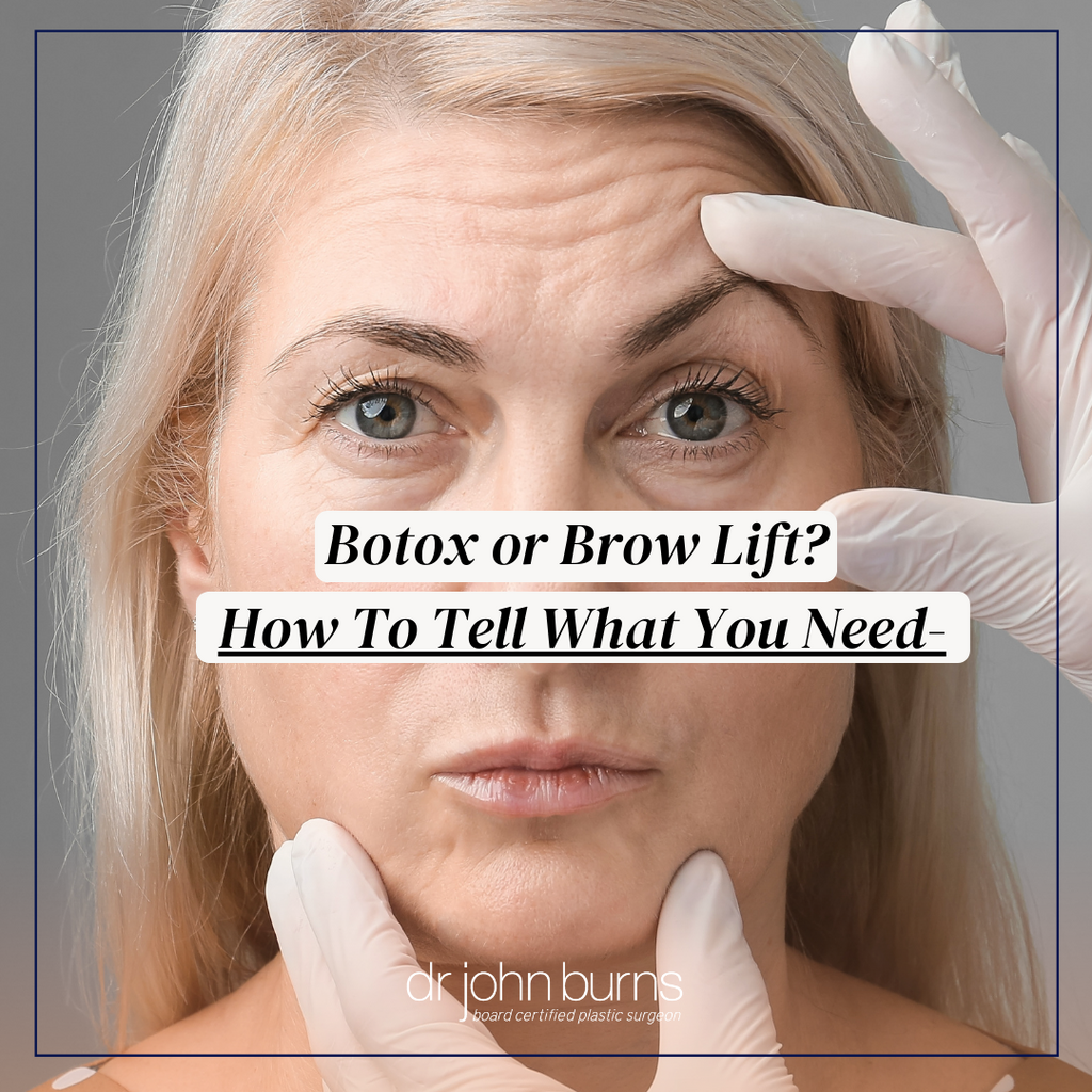 spontaan Monopoly regeling Botox or Brow Lift? How To Tell What You Really Need- – Dr John Burns