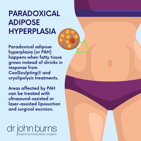 Paradoxical Adipose Hyperplasia, (PAH) from CoolSculpting Treatment