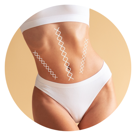 abdomen of caucasian woman in white swimsuit with three vector demonstration over abs