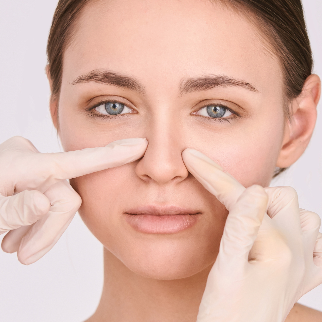 Cosmetic Nose Job in Dallas, Tx by Dr. John Burns