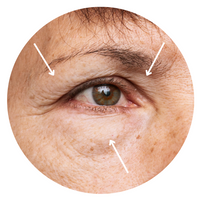eyelid hooding with lower eye bag on middle aged caucasian woman