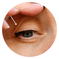 Excess eyelid skin- loose eyelid skin at upper eyelid on middle-aged caucasian female