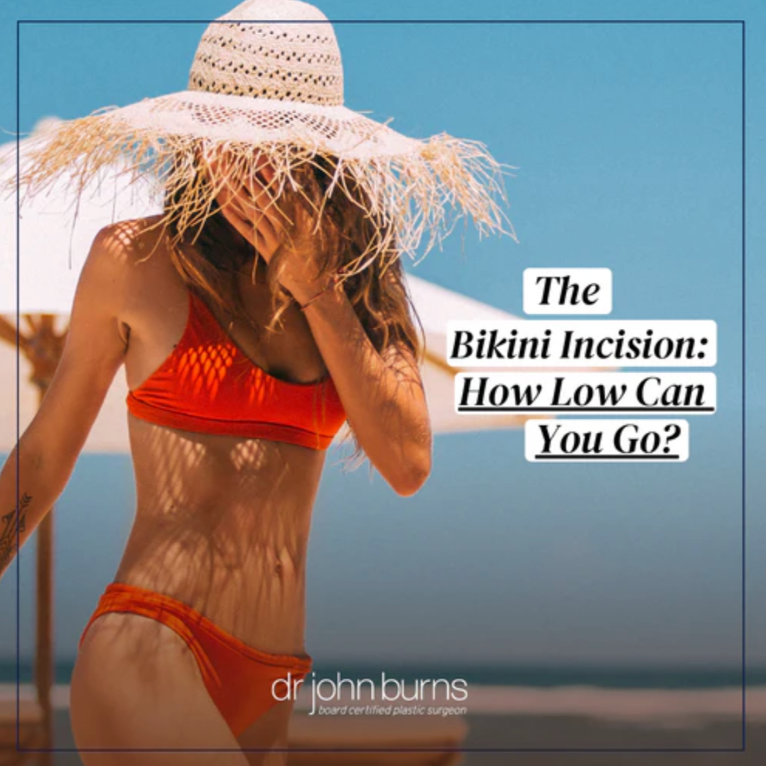 Bikini Incision- How Low Can You Go?- Dr. John Burns.png__PID:575389fe-168f-4e39-ba51-491f7bd1c359