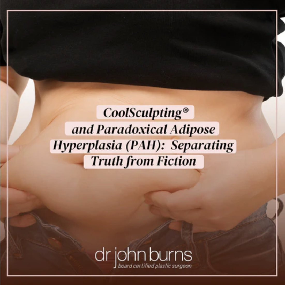 Coolsculpting and Paradoxical Fat Hyperplasia.png__PID:d3c4ed48-ff32-4ade-8952-f58e28428c77
