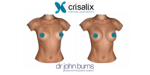 Crisalix in Dallas, TX- Dr. John Burns.png__PID:11260380-8506-41f1-9ef9-06e37dcf6982