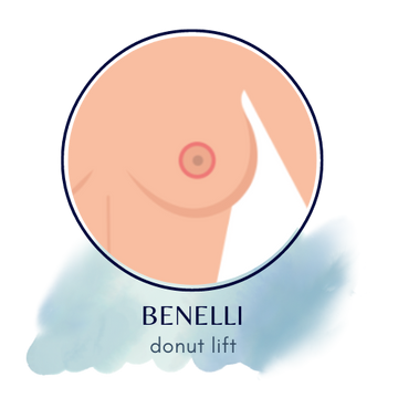 Benelli breast lift incision line