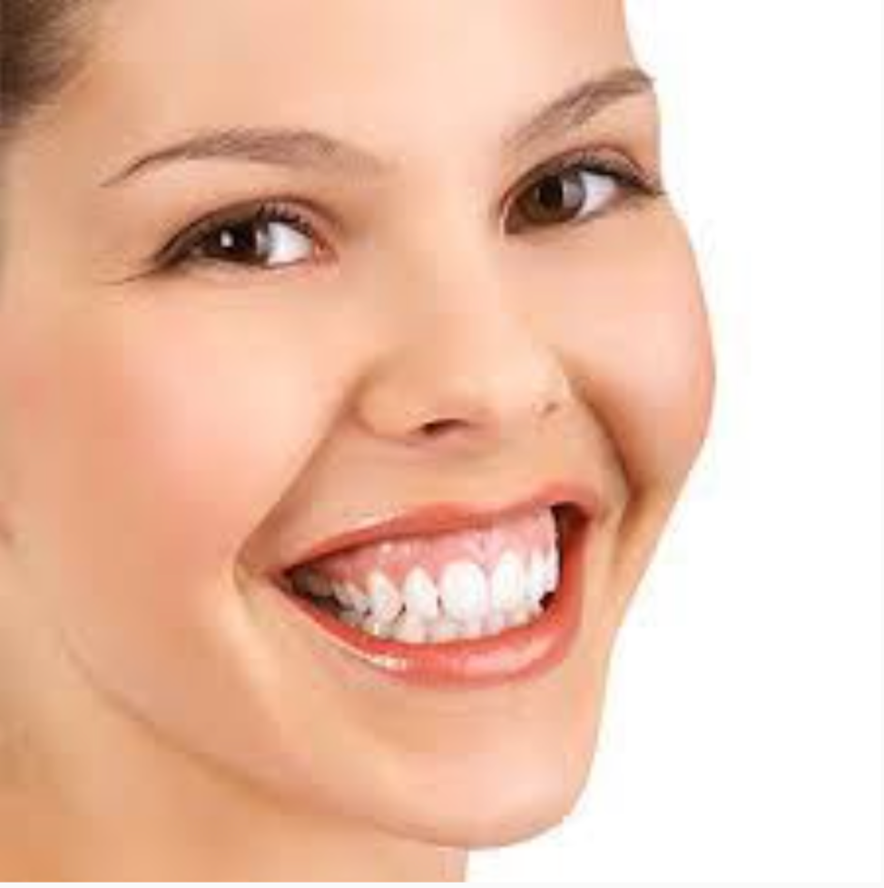 Gummy Smile Treatments.png__PID:c655310b-1a0a-4879-9595-0d82a3a7567b
