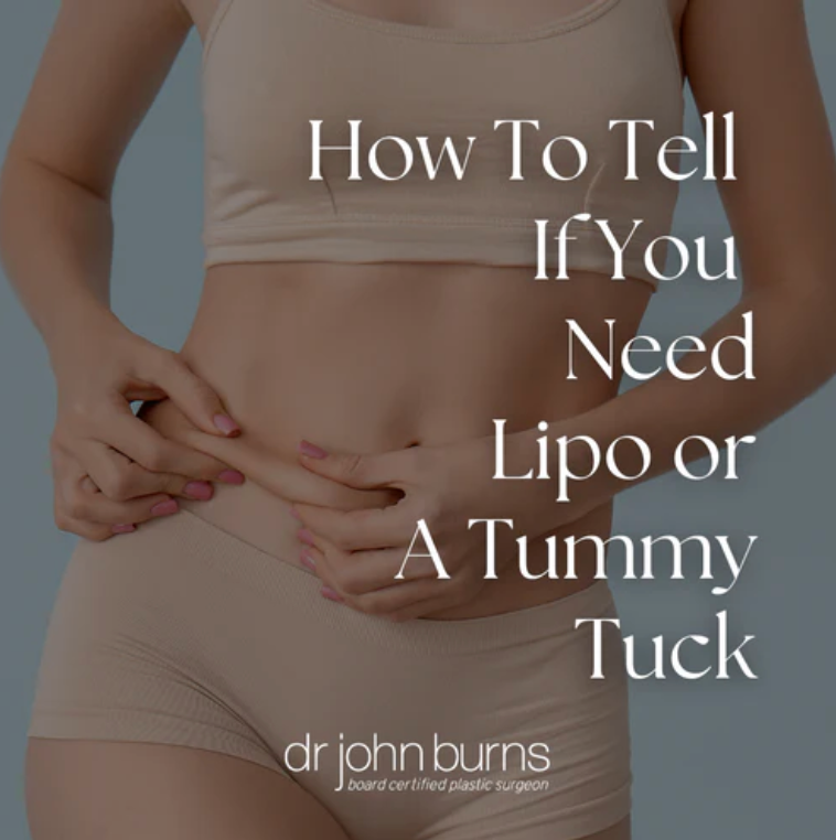 How To Tell If You Need Lipo or A Tummy Tuck- Dr. John Burns.png__PID:a6024555-89f0-44c8-8480-5cfd591cecb3
