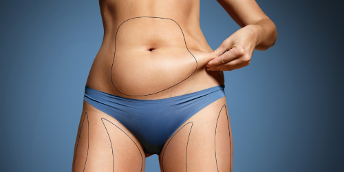 Liposuction Body Contouring in Dallas, Texas- Dr. John Burns.png__PID:207eb126-657e-4c19-a367-a2119947751f