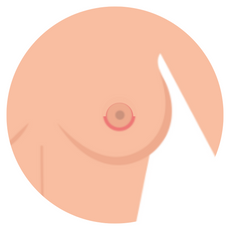 crescent breast lift by Dr. John Burns.png__PID:3c07f72c-6eb8-465d-8ef0-aed37f83f616