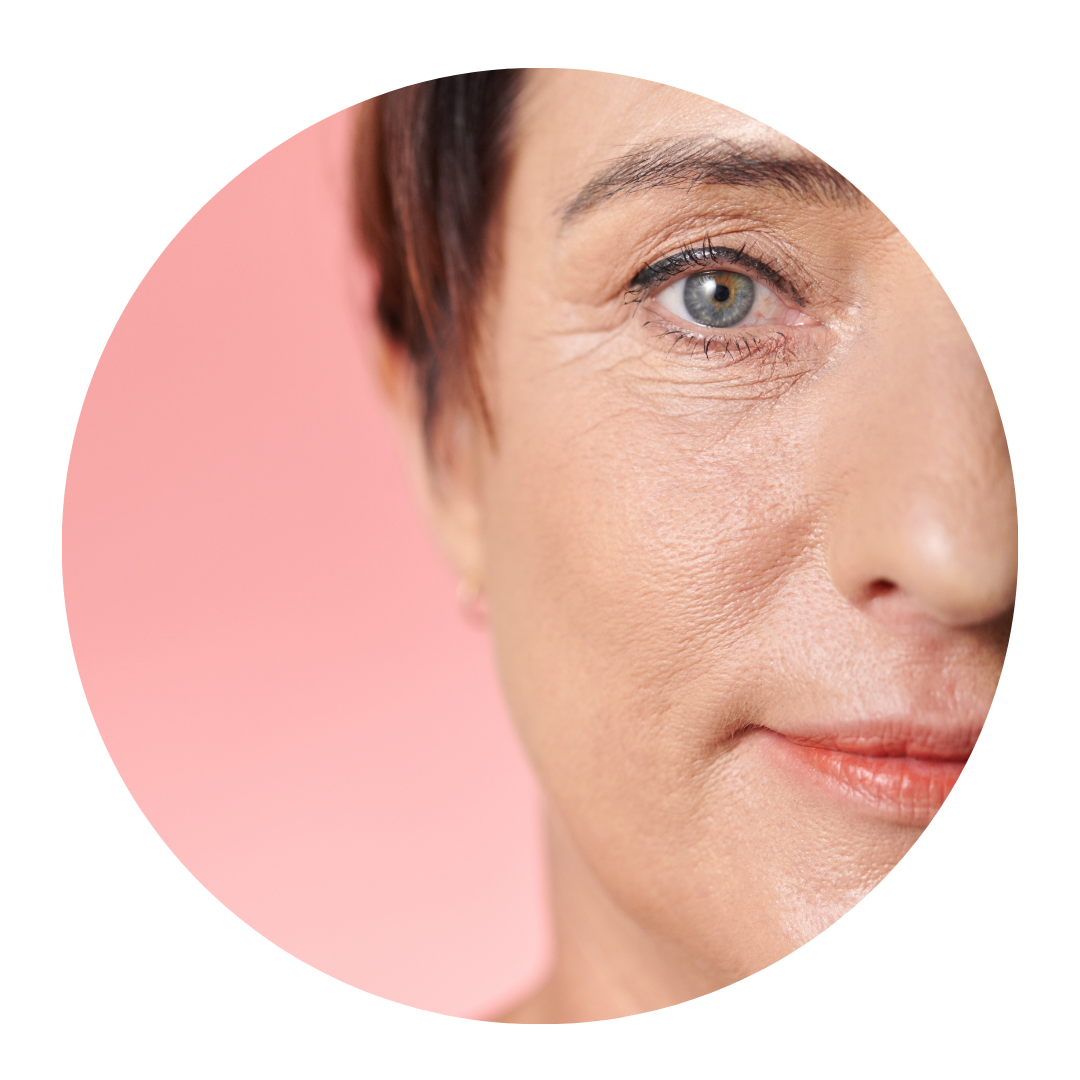 deep wrinkles- neck lift surgeon.png__PID:9aaf6a6e-6d2e-400d-9b83-575b83566e60