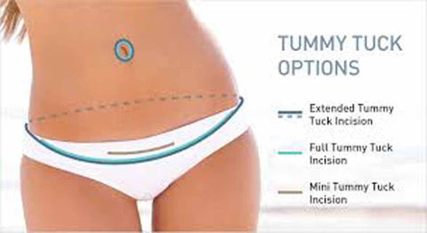 Mini, Standard & Extended Tummy Tucks vs Body Lifts - ABCS