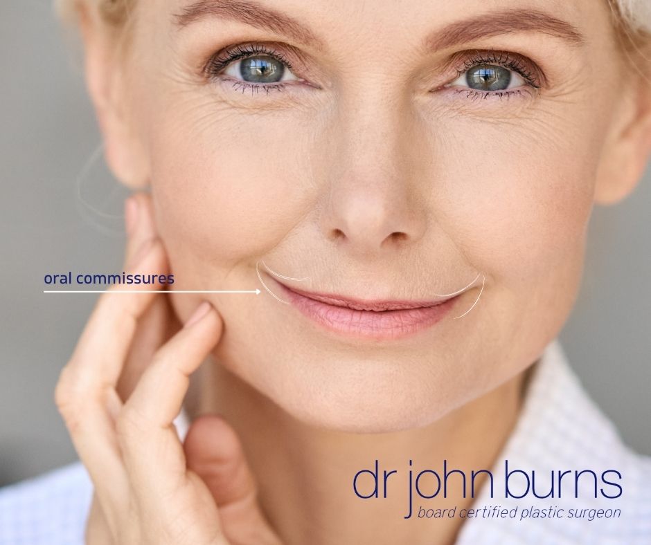 Erasing Lip Lines and Wrinkles - Refreshed Aesthetic Surgery Blog