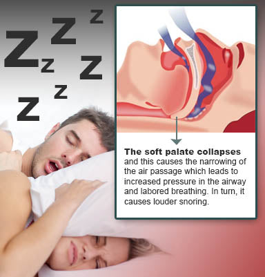 The cause of snoring