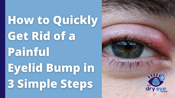 how-to-quickly-get-rid-of-a-painful-eyelid-bump-in-3-simple-steps-eye