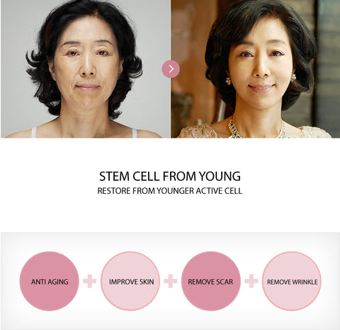 stem cell therapies korea