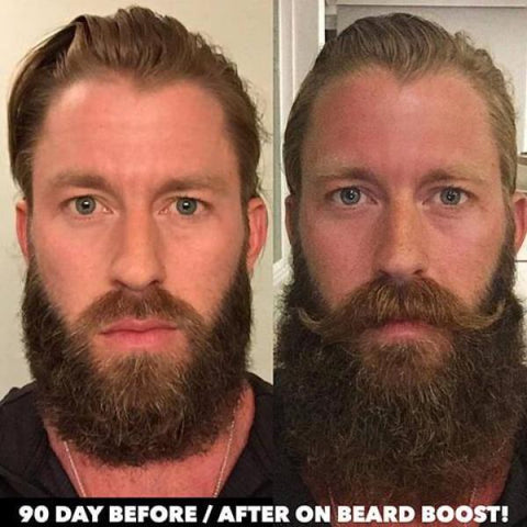 Before and After beard - Spencer