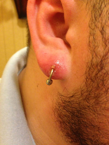 Cartilage Piercing Bumps: Causes, Treatment, and Prevention | Expert A –  Chronic Ink