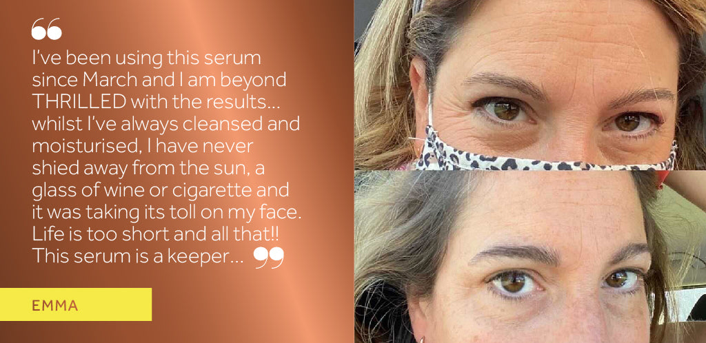 Before and after photos of the top half of a white woman's face showing wrinkles around the eye area before using Maxerum serum and reduced wrinkles after using Maxerum serum, alongside a positive review