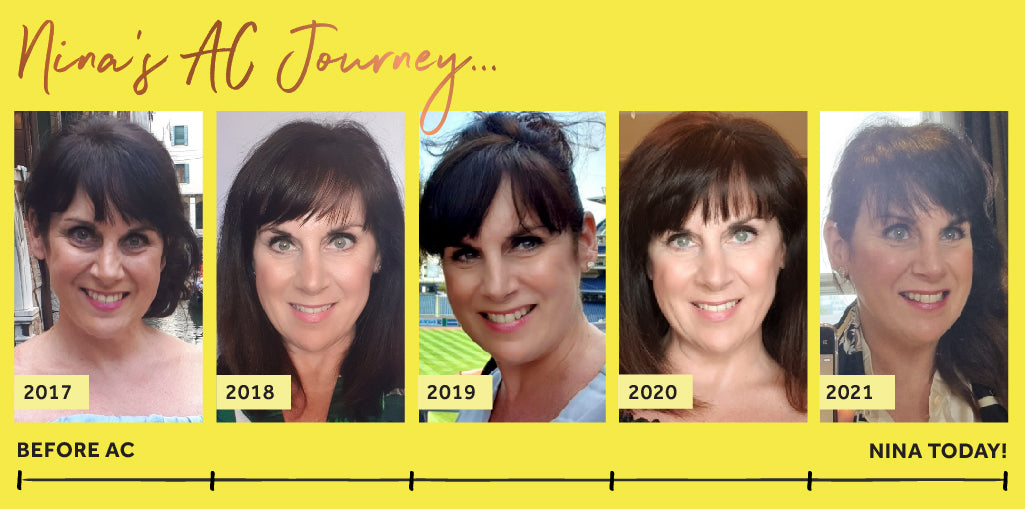 Photos of Nina, a white woman with brunette hair, showing Nina's Absolute Collagen journey dated 2017 to the present day showing the different stages of her journey