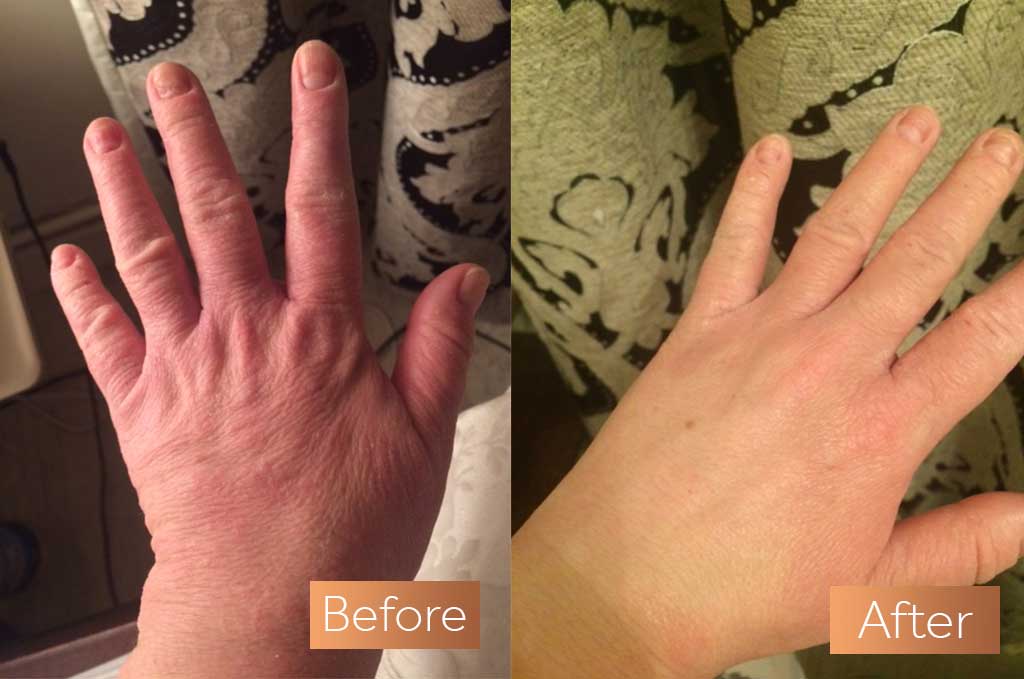 Absolute Collagen supplement before and after nails growth strength split
